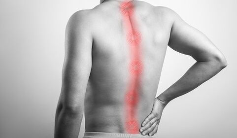 Verschiedene Rückenverletzungen verursachen Schmerzen im Lendenbereich