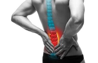 Osteochondrose ist eine Erkrankung der Wirbelsäule.