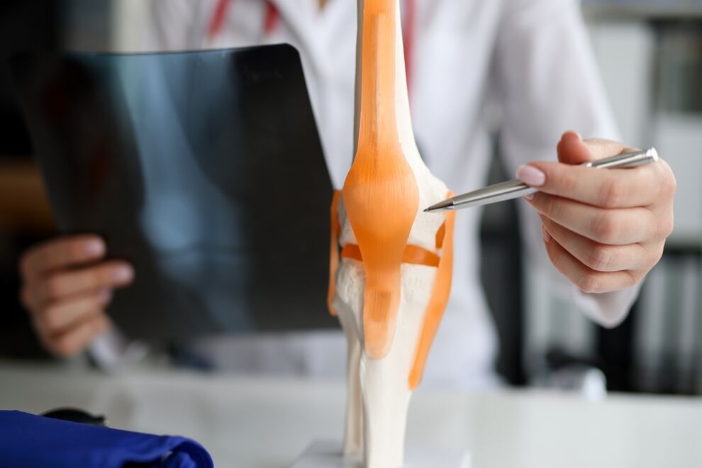 Darstellung eines Gelenks, bei dem degenerative Veränderungen zur Entstehung einer Arthrose führen.