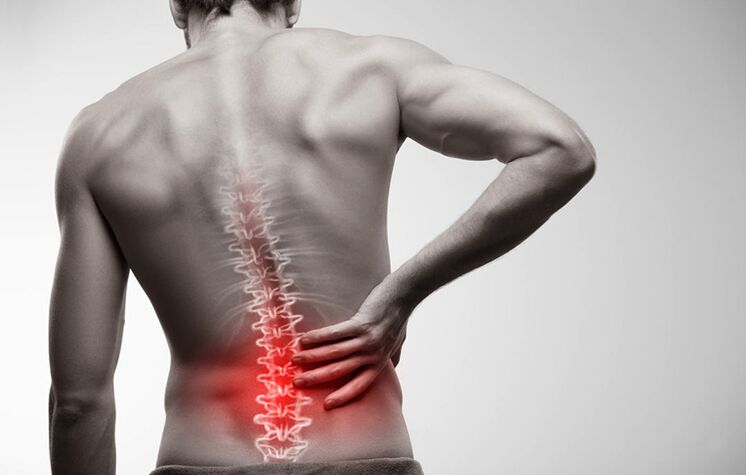 Schmerzen im unteren Rücken aufgrund von Osteochondrose